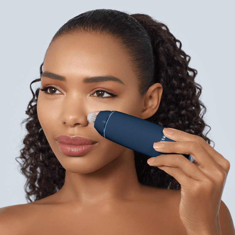 Мікродермабразійний пристрій для видалення чорних цяток GESKE MicroDermabrasion Blackhead Remover 7 в 1 midnight