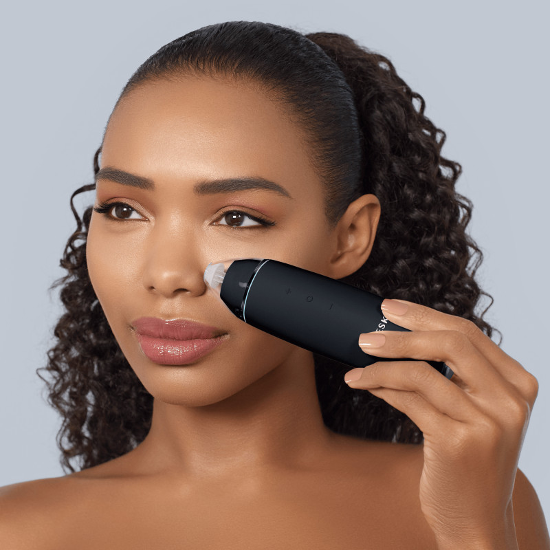 Мікродермабразійний пристрій для видалення чорних цяток GESKE MicroDermabrasion Blackhead Remover black