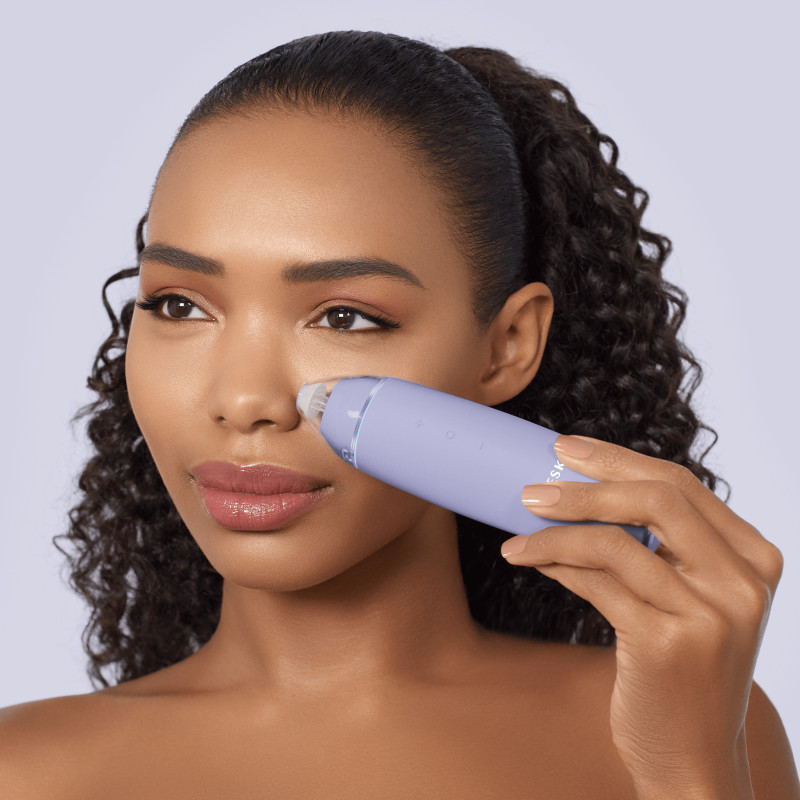 Мікродермабразійний пристрій для видалення чорних цяток GESKE MicroDermabrasion Blackhead Remover purple